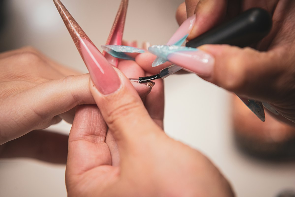 Iron deficiency and hair loss